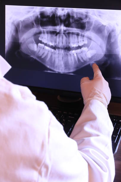 Best Chipped Tooth Repair Near Me  in Arvin, CA
